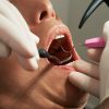 dental filling